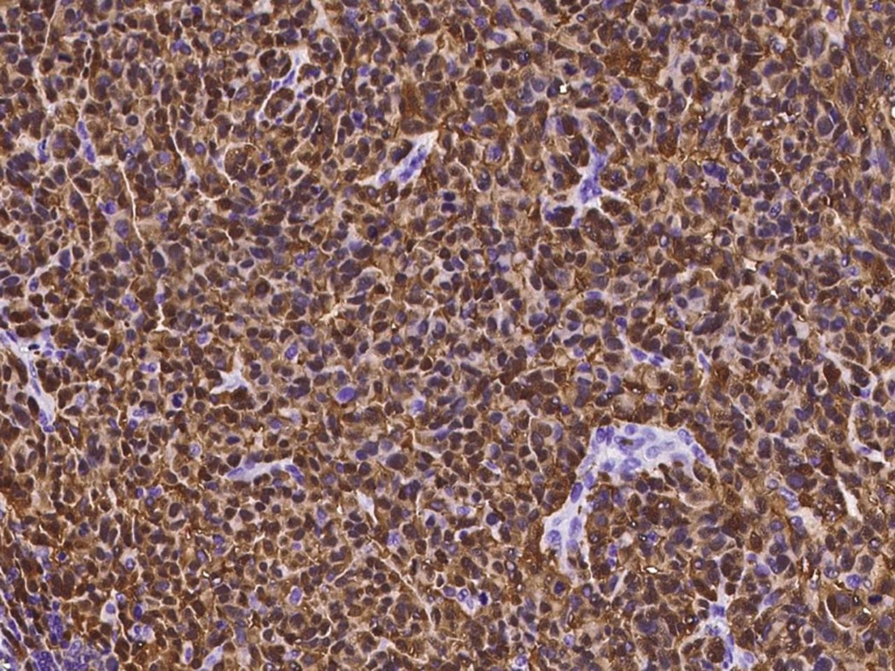 Monoclonal Mouse anti-Human S100B / S100 Beta Antibody (clone 03, Preservative Free, IHC)