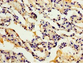 Polyclonal Rabbit anti-Human ADAM33 Antibody (aa140-420, IHC)