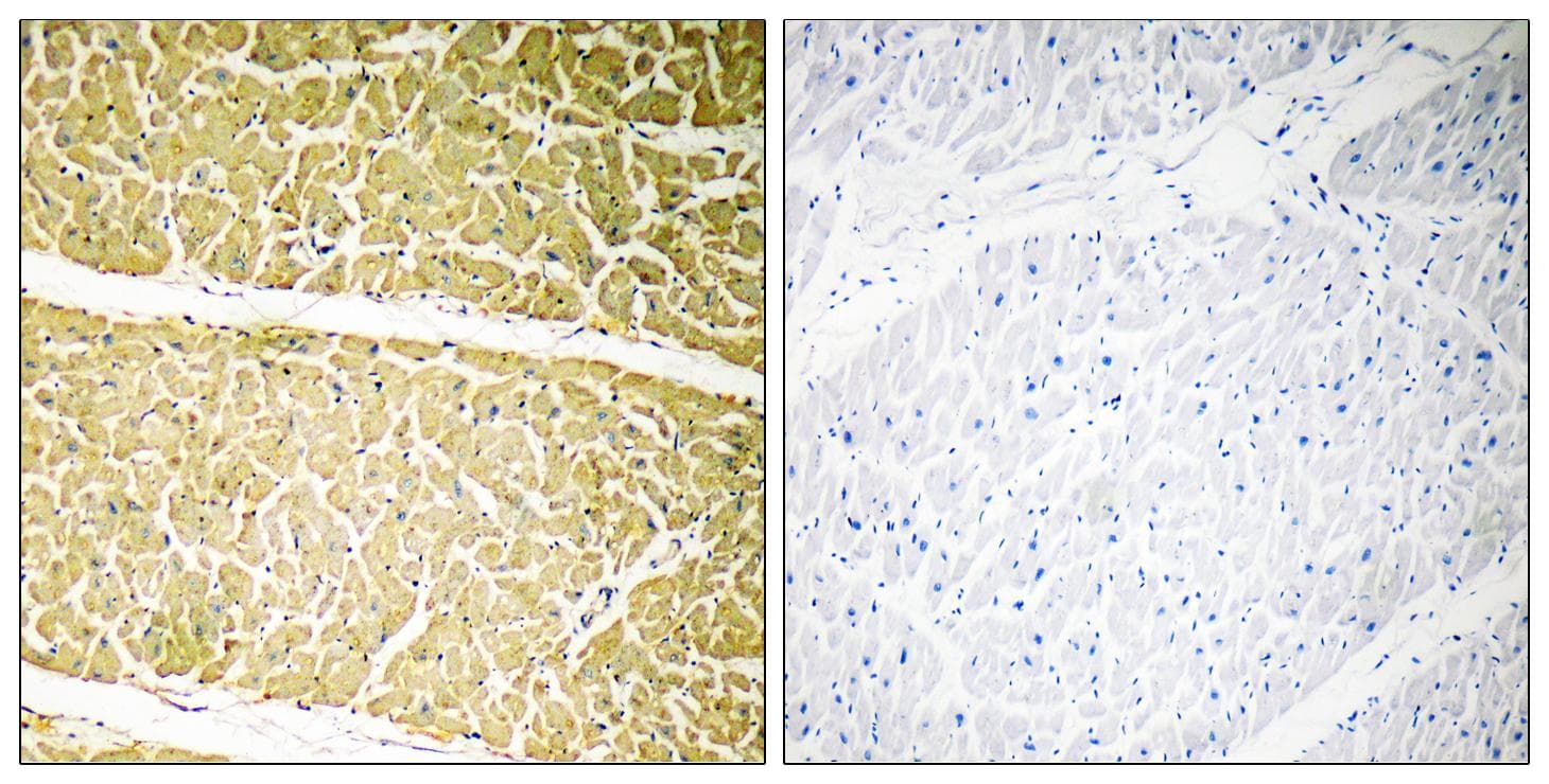 Complement C6 Antibody