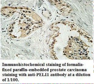 PELI1 / Pellino 1 Antibody (aa145-404)