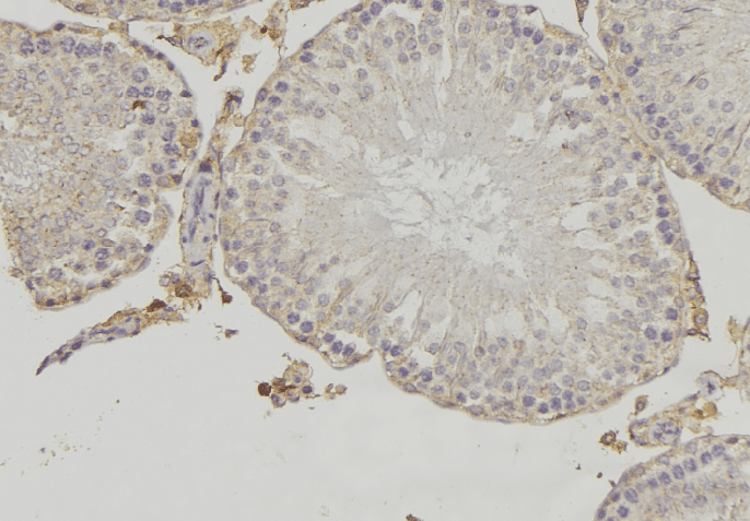 Polyclonal Rabbit anti-Human CYLC1 Antibody (IHC, WB)