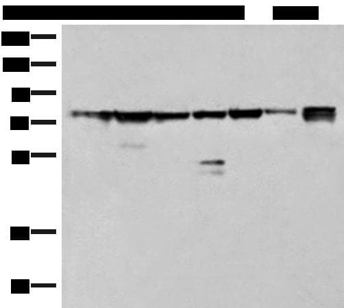 Polyclonal Rabbit anti-Human THNSL1 Antibody (IHC, WB)
