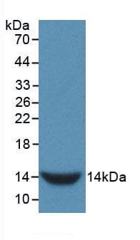 GNRH Antibody (aa25-92)