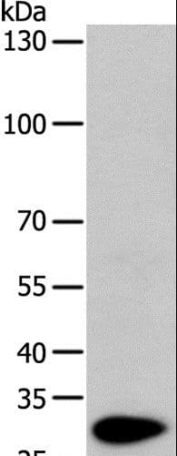 TPM1 / Tropomyosin Antibody