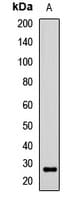NOG / Noggin Antibody