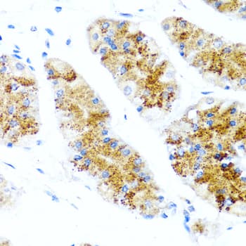 SIRT1 / Sirtuin 1 Antibody