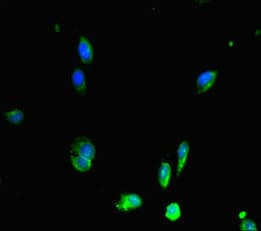 RAD51 / RECA Antibody
