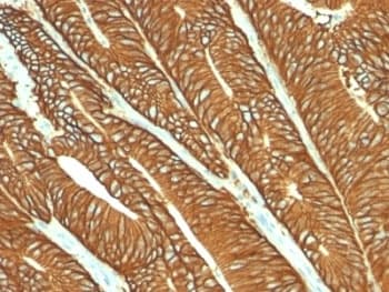EPCAM Antibody (clone MOC-31)