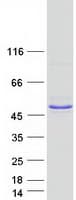 Human NEIL2 Protein (Recombinant Myc-DDK (Flag))