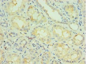 ARA70 / NCOA4 Antibody (aa1-280)