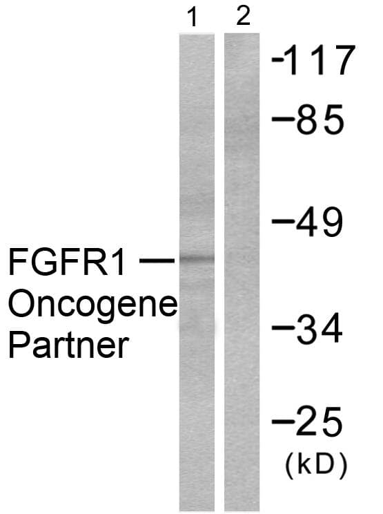 FGFR1OP / FOP Antibody (aa341-390)