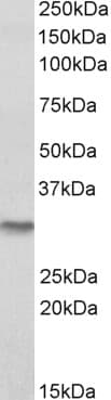IHC-plus™ NQO1 Antibody (aa134-146)