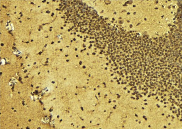 Polyclonal Rabbit anti-Human ZSCAN22 Antibody (IHC, IF, WB)