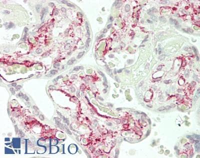 IHC-plus™ FZD1 / Frizzled 1 Antibody (aa6-55)