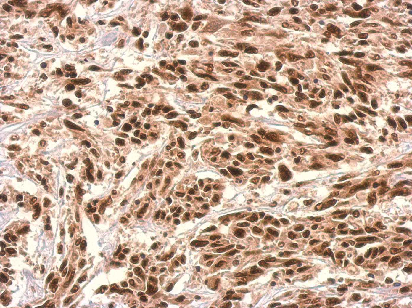 Polyclonal Rabbit anti-Human UTP6 Antibody (aa213-597, IHC, WB)