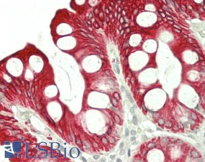 IHC-plus™ KRT20 / CK20 / Cytokeratin 20 Antibody (clone MKs20-8)