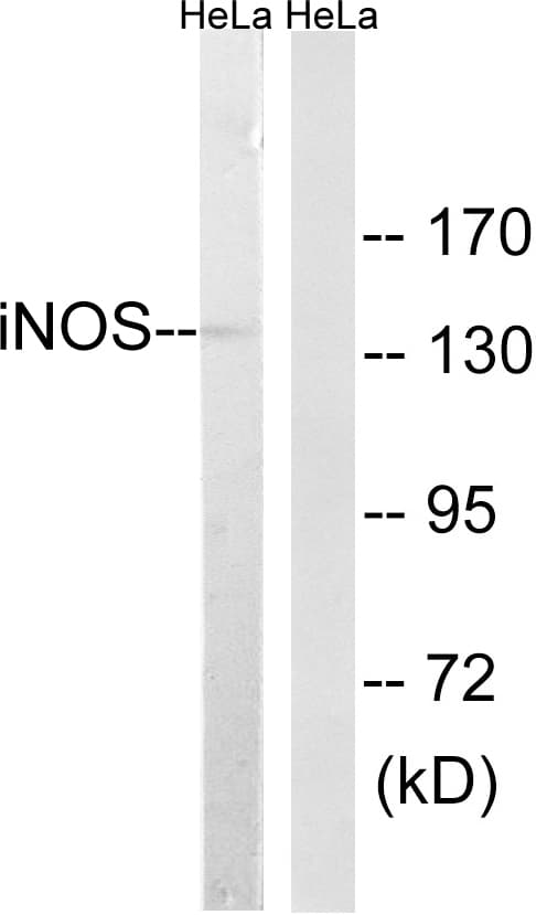 NOS2 / iNOS Antibody (aa1101-1150)