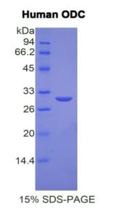 Human ODC1 / Ornithine Decarboxylase Protein (Recombinant His)