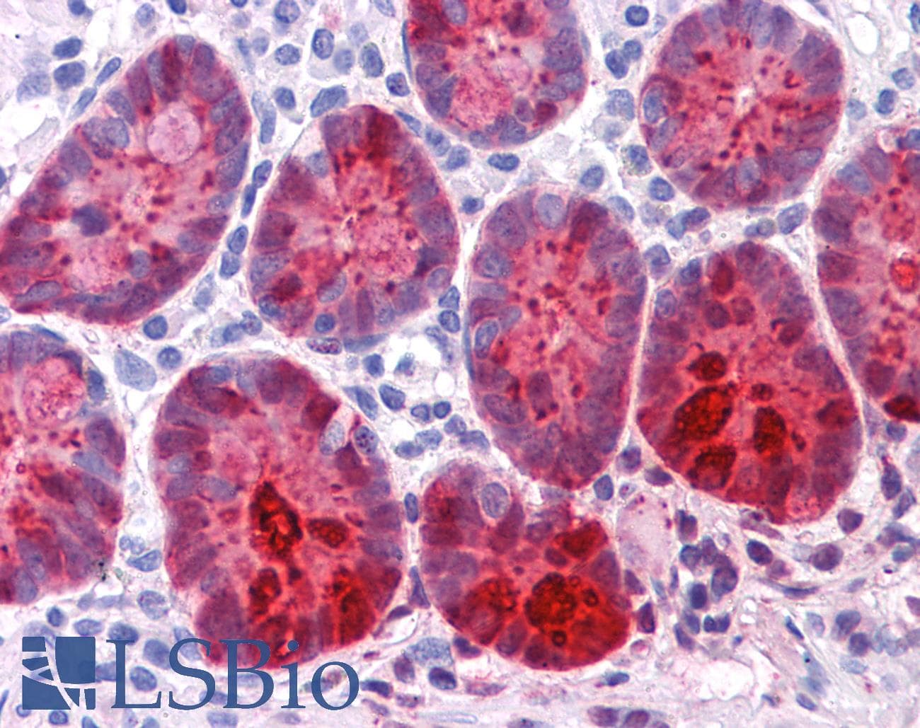 IHC-plus™ Monoclonal Mouse anti-Human REG1A Antibody (clone 1A4, IHC, IF)