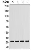 PathPlus™ Polyclonal Rabbit anti-Human PDCD1 / CD279 / PD-1 Antibody (Internal, IHC, WB)