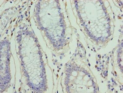 Polyclonal Rabbit anti-Human ZNF555 Antibody (IHC, WB)