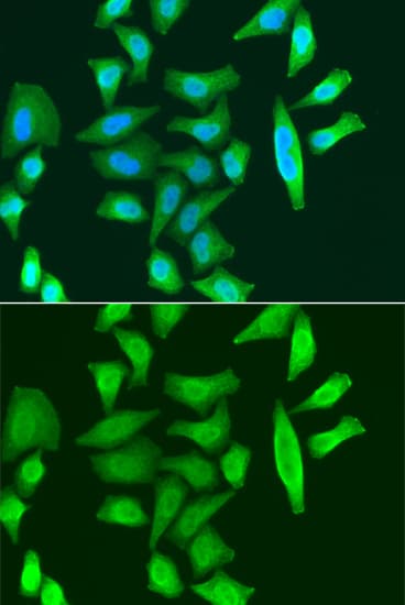 CDC5 / CDC5L Antibody