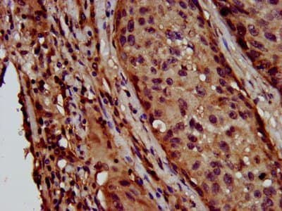 LAPTM4B Antibody