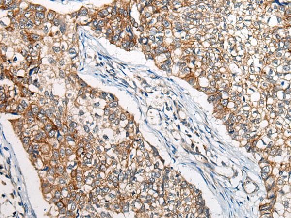 Polyclonal Rabbit anti-Human BBS12 Antibody (IHC)