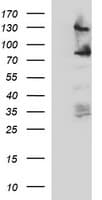 Monoclonal Mouse anti-Human CD44 Antibody (clone OTI5B5, IHC, IF, WB)