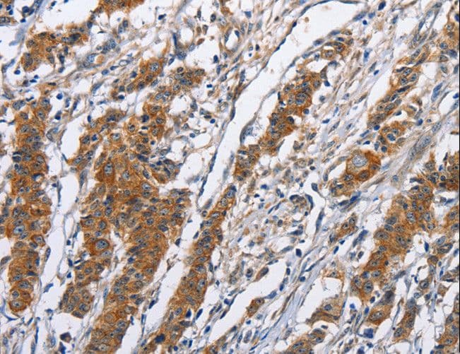 Polyclonal Rabbit anti-Human NCAPD3 / HCAP-D3 Antibody (IHC)