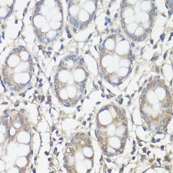 FAK / Focal Adhesion Kinase Antibody