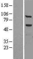 Human Alpha Fucosidase / FUCA1 Protein (Over-Expression Lysate Myc-DDK (Flag))