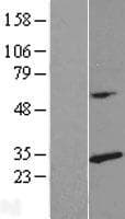 RPL14 / Ribosomal Protein L14 (Over-Expression Lysate Myc-DDK (Flag))