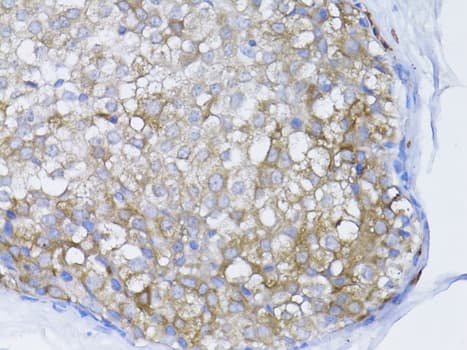 Polyclonal Rabbit anti-Human BRCA1 Antibody (IHC, IF, WB)