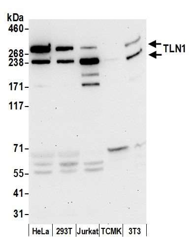 TLN1 / Talin 1 Antibody (aa1875-1925)