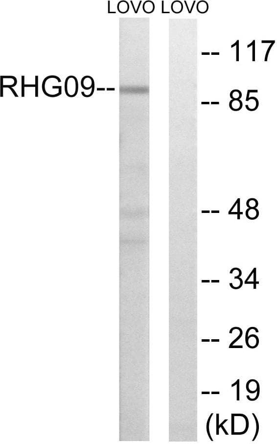 Polyclonal Rabbit anti-Human ARHGAP9 Antibody (WB)
