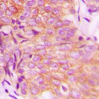 EPS8L3 Antibody (Internal)