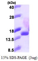 Human EIF1B Protein (Recombinant His)