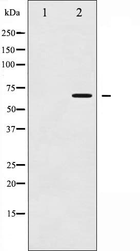 CHEK2 / CHK2 Antibody (phospho-Thr387)