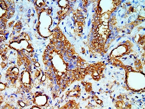 Mesothelial Cells Antibody (clone HBME-1)
