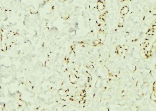 Polyclonal Rabbit anti-Human PTPN11 / SHP-2 / NS1 Antibody (IHC, IF, WB)