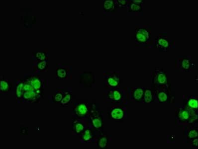 Polyclonal Rabbit anti-Human ZNF596 Antibody (IHC)
