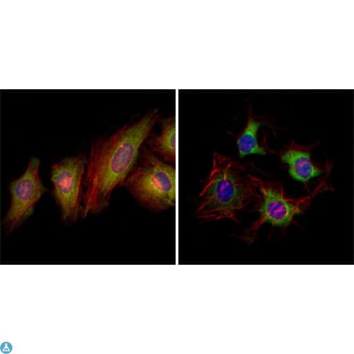 Monoclonal Mouse anti-Human EPHB2 / EPH Receptor B2 Antibody (IF, WB)