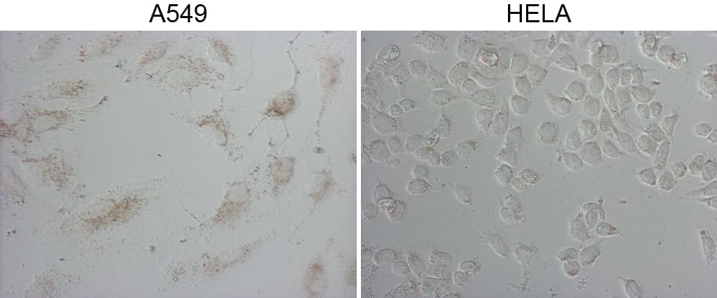 Monoclonal Mouse anti-Human NAPSA / NAPA / Napsin A Antibody (clone OTI4G9, aa64-244, IF)