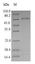 Human DSN1 Protein (Recombinant GST, N-terminus)