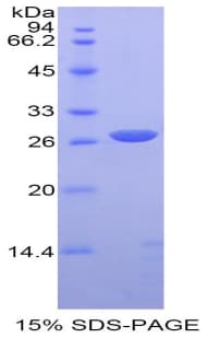 Mouse SPTAN1 / Alpha Fodrin Protein (Recombinant His)
