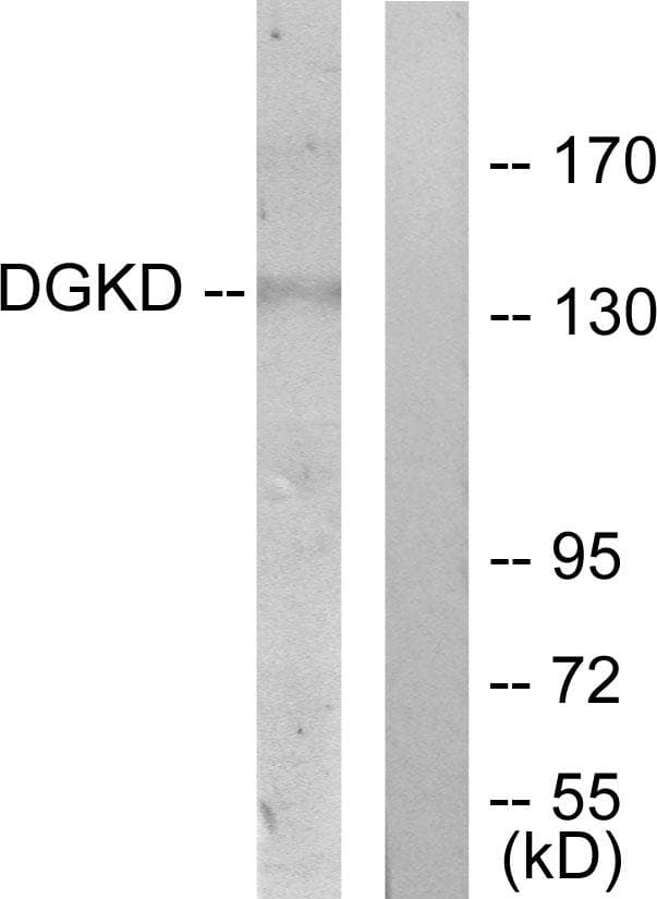 Polyclonal Rabbit anti-Human DGKD Antibody (WB)