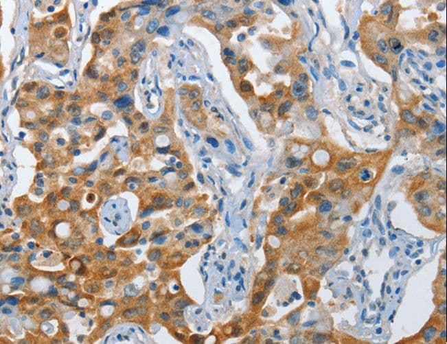 NOL3 / ARC Antibody