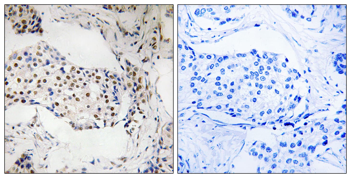 POLR1E Antibody