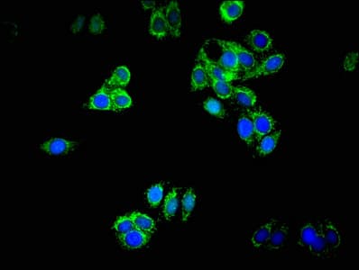 DNAJB11 Antibody